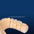 zirconia ທີ່ນິຍົມສໍາລັບການຟື້ນຟູທັນຕະແພດ